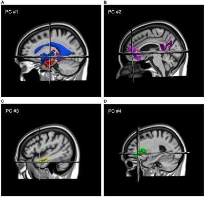 Volumetric brain correlates of gait associated with cognitive decline in community-dwelling older adults